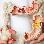 Phòng khám ung bướu Singapore - Việt Nam