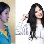 Thảo trước và sau khi thẩm mỹ