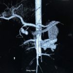 Hình chụp X-Quang phổi của bệnh nhi