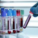 Xét nghiệm máu