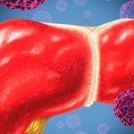 Xét nghiệm ung thư gan